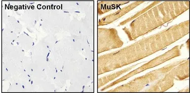 Anti-MUSK antibody used in IHC (Paraffin sections) (IHC-P). GTX25619