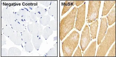 Anti-MUSK antibody used in IHC (Paraffin sections) (IHC-P). GTX25619