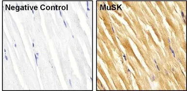 Anti-MUSK antibody used in IHC (Paraffin sections) (IHC-P). GTX25619