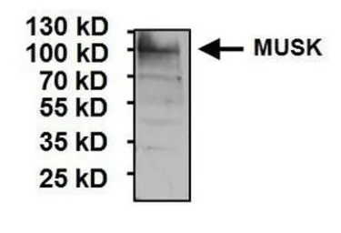 Anti-MUSK antibody used in Western Blot (WB). GTX25619