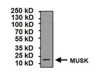 Anti-MUSK antibody used in Western Blot (WB). GTX25619