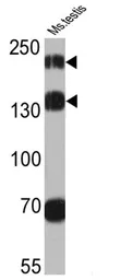 Anti-Proteosome Activator, 200 kDa antibody used in Western Blot (WB). GTX25620