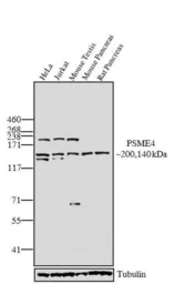 Anti-Proteosome Activator, 200 kDa antibody used in Western Blot (WB). GTX25620