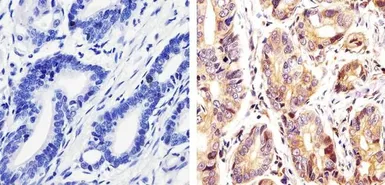 Anti-c-Kit (phospho Tyr730) antibody used in IHC (Paraffin sections) (IHC-P). GTX25633