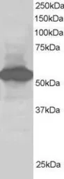 Anti-SIL1 antibody, C-term used in Western Blot (WB). GTX25639