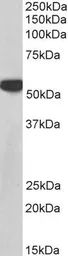 Anti-PTBP1 antibody, N-term used in Western Blot (WB). GTX25642