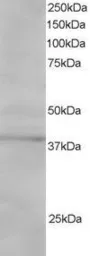 Anti-SAE1 antibody, C-term used in Western Blot (WB). GTX25645