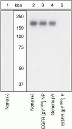 Anti-EGFR (phospho Tyr1086) antibody used in Western Blot (WB). GTX25650