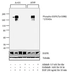 Anti-EGFR (phospho Tyr1086) antibody used in Western Blot (WB). GTX25650