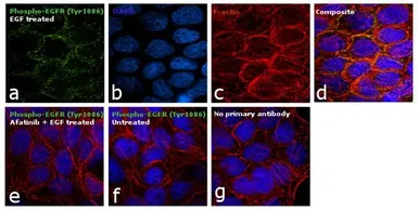 Anti-EGFR (phospho Tyr1086) antibody used in Immunocytochemistry/ Immunofluorescence (ICC/IF). GTX25650