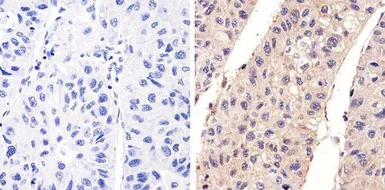 Anti-EGFR (phospho Tyr1173) antibody used in IHC (Paraffin sections) (IHC-P). GTX25652