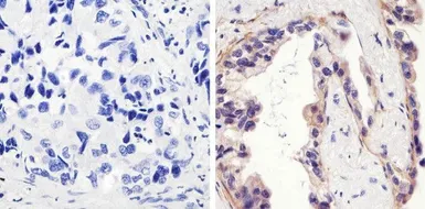 Anti-EGFR (phospho Tyr1173) antibody used in IHC (Paraffin sections) (IHC-P). GTX25652