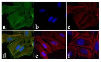 Anti-EGFR (phospho Tyr1173) antibody used in Immunocytochemistry/ Immunofluorescence (ICC/IF). GTX25652
