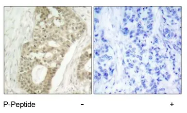 Anti-PKC delta (phospho Ser645) antibody used in IHC (Paraffin sections) (IHC-P). GTX25657