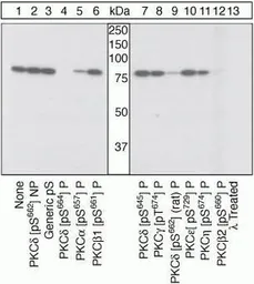 Anti-PKC delta (phospho Ser664) antibody used in Western Blot (WB). GTX25658