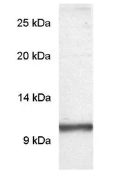 Anti-PDE6 gamma antibody used in Western Blot (WB). GTX25664