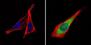 Anti-PDE6D antibody used in Immunocytochemistry/ Immunofluorescence (ICC/IF). GTX25665