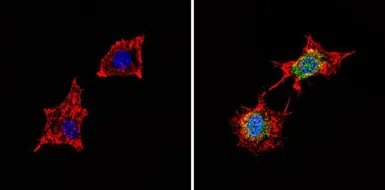 Anti-PDE6D antibody used in Immunocytochemistry/ Immunofluorescence (ICC/IF). GTX25665