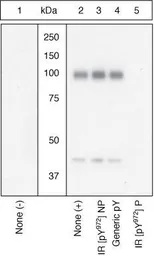 Anti-Insulin Receptor beta (phospho Tyr960) antibody used in Western Blot (WB). GTX25678
