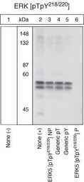 Anti-ERK5 (phospho Thr218/Tyr220) antibody used in Western Blot (WB). GTX25686