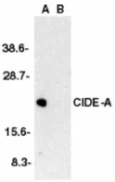 Anti-CIDE A antibody used in Western Blot (WB). GTX25692