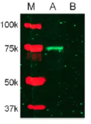 Anti-MMP2 antibody used in Western Blot (WB). GTX25704