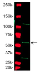 Anti-MMP10 antibody used in Western Blot (WB). GTX25708