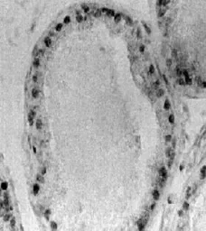 Anti-Estrogen Receptor beta antibody used in IHC (Paraffin sections) (IHC-P). GTX25786