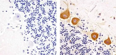 Anti-PKC gamma (phospho Thr655) antibody used in IHC (Paraffin sections) (IHC-P). GTX25796