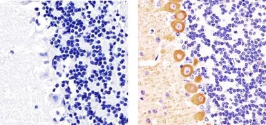 Anti-PKC gamma (phospho Thr655) antibody used in IHC (Paraffin sections) (IHC-P). GTX25796
