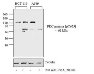 Anti-PKC gamma (phospho Thr655) antibody used in Western Blot (WB). GTX25796