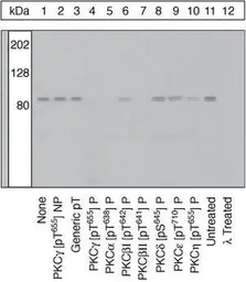 Anti-PKC gamma (phospho Thr655) antibody used in Western Blot (WB). GTX25796