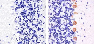 Anti-PKC gamma (phospho Thr674) antibody used in IHC (Paraffin sections) (IHC-P). GTX25797