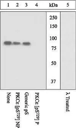 Anti-PKC epsilon (phospho Ser729) antibody used in Western Blot (WB). GTX25811