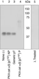 Anti-PKA alpha + beta (phospho Thr197) antibody used in Western Blot (WB). GTX25815