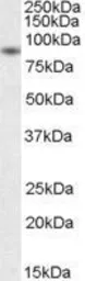 Anti-BAG3 antibody, C-term used in Western Blot (WB). GTX25898