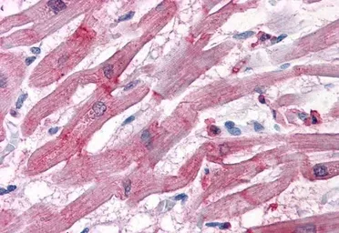 Anti-BAG3 antibody, C-term used in IHC (Paraffin sections) (IHC-P). GTX25898