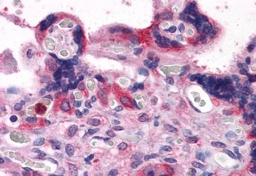 Anti-BAG3 antibody, C-term used in IHC (Paraffin sections) (IHC-P). GTX25898