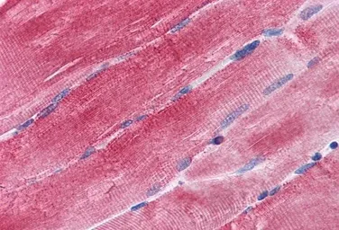 Anti-BAG3 antibody, C-term used in IHC (Paraffin sections) (IHC-P). GTX25898