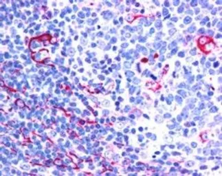 Anti-NET1 antibody, C-term used in IHC (Paraffin sections) (IHC-P). GTX25914