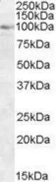 Anti-OSBP antibody, C-term used in Western Blot (WB). GTX25915