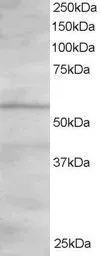 Anti-OSBPL2 antibody, C-term used in Western Blot (WB). GTX25921