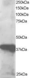 Anti-GIPC3 antibody, N-term used in Western Blot (WB). GTX25950