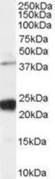 Anti-GIPC1 antibody, C-term used in Western Blot (WB). GTX25951