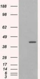 Anti-GIPC1 antibody, C-term used in Western Blot (WB). GTX25951