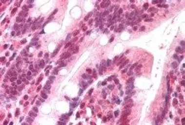 Anti-DNA polymerase lambda antibody, C-term used in IHC (Paraffin sections) (IHC-P). GTX25954