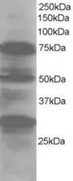 Anti-LMO7 antibody, Internal used in Western Blot (WB). GTX25955