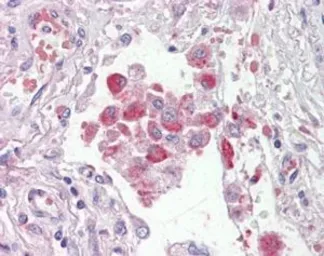 Anti-OSBPL9 antibody, C-term used in IHC (Paraffin sections) (IHC-P). GTX25960