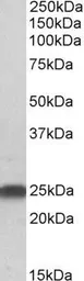 Anti-LIN7B antibody, N-term used in Western Blot (WB). GTX25967