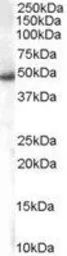 Anti-SNX5 antibody, C-term used in Western Blot (WB). GTX25983